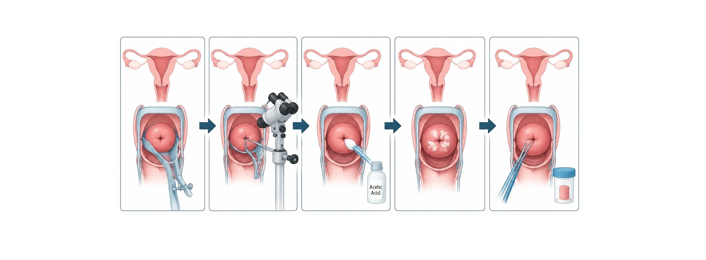 Colposcopy